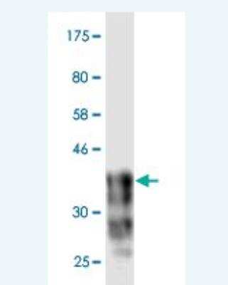 Western Blot: Cadherin-18 Antibody (4H2) [H00001016-M02]