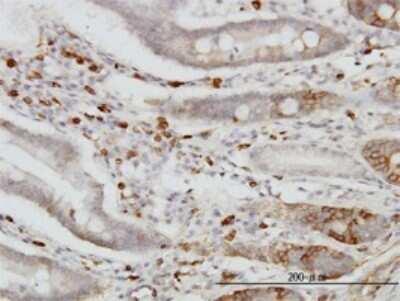 Immunohistochemistry-Paraffin: Cadherin-18 Antibody (6F7) [H00001016-M01]