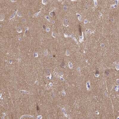 Immunohistochemistry-Paraffin: Cadherin-18 Antibody [NBP2-48527]