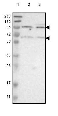 Western Blot: Cadherin-18 Antibody [NBP2-48527]