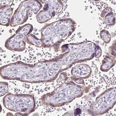 Immunohistochemistry-Paraffin: Cadherin-19 Antibody [NBP2-49222]