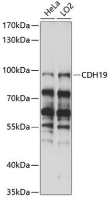 Western Blot: Cadherin-19 AntibodyAzide and BSA Free [NBP3-03597]