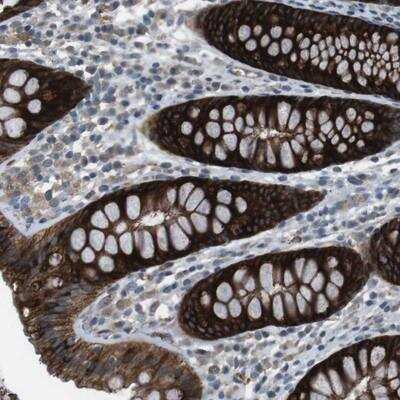 Immunohistochemistry-Paraffin: Cadherin-20 Antibody [NBP1-85713]