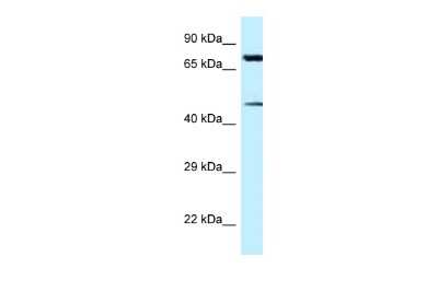 Western Blot: Cadherin-22 Antibody [NBP2-84581]