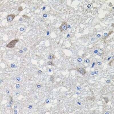 Immunohistochemistry-Paraffin: Cadherin-23 Antibody - Azide and BSA Free [NBP3-03833]