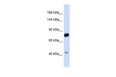 Western Blot: Cadherin-23 Antibody [NBP2-87114]