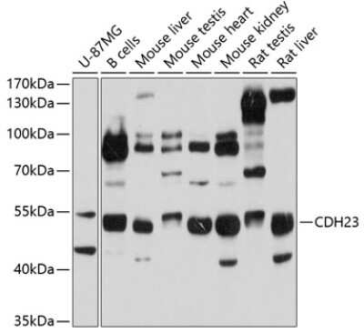 Western Blot: Cadherin-23 AntibodyBSA Free [NBP2-92450]