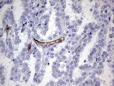 Immunohistochemistry: Cadherin-4/R-Cadherin Antibody (OTI4F5) [NBP2-46208]