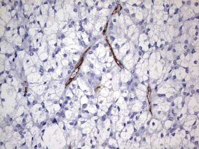 Immunohistochemistry: Cadherin-4/R-Cadherin Antibody (OTI4F5) [NBP2-46208]