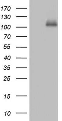 Western Blot: Cadherin-4/R-Cadherin Antibody (OTI4F5) [NBP2-46208]