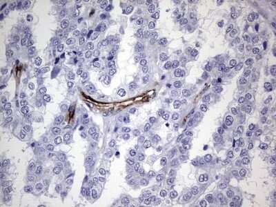 Immunohistochemistry: Cadherin-4/R-Cadherin Antibody (OTI4F5) - Azide and BSA Free [NBP2-70384]