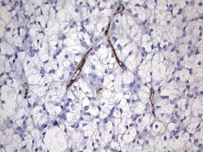 Immunohistochemistry: Cadherin-4/R-Cadherin Antibody (OTI4F5) - Azide and BSA Free [NBP2-70384]