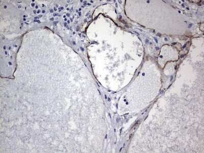 Immunohistochemistry: Cadherin-4/R-Cadherin Antibody (OTI4F5) - Azide and BSA Free [NBP2-70384]