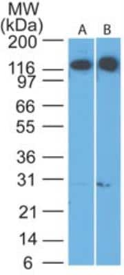 Western Blot: Cadherin-4/R-Cadherin Antibody [NBP2-27372]