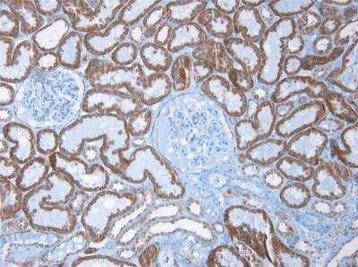 Immunohistochemistry-Paraffin: Cadherin-6/KCAD Antibody (2B6) - BSA Free [NBP1-97689]