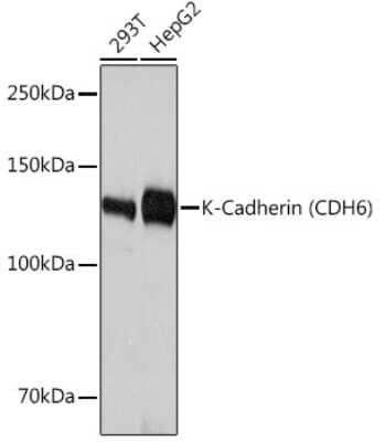 Western Blot: Cadherin-6/KCAD Antibody (5N2K3) [NBP3-16464]