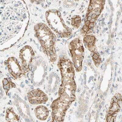 Immunohistochemistry-Paraffin: Cadherin-6/KCAD Antibody [NBP1-87588]