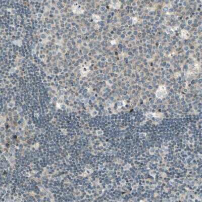 Immunohistochemistry-Paraffin: Cadherin-6/KCAD Antibody [NBP1-87588]