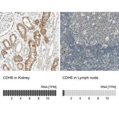 Immunohistochemistry-Paraffin: Cadherin-6/KCAD Antibody [NBP1-87588]