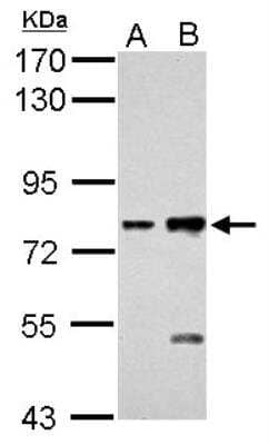 Western Blot: Cadherin-6/KCAD Antibody [NBP2-17011]