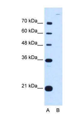 Western Blot: Cadherin-7 Antibody [NBP1-59270]