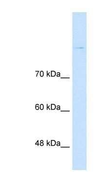 Western Blot: Cadherin-8 Antibody [NBP1-59221]