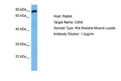 Western Blot: Cadherin-8 Antibody [NBP2-84583]
