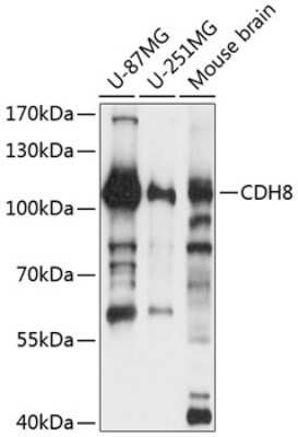 Western Blot: Cadherin-8 AntibodyAzide and BSA Free [NBP2-92143]