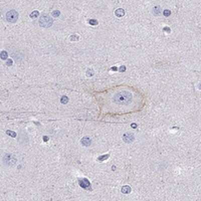 Immunohistochemistry-Paraffin: Cadherin-9 Antibody [NBP1-86498]