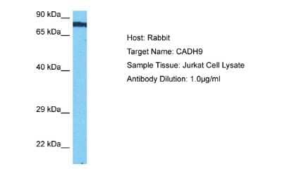 Western Blot: Cadherin-9 Antibody [NBP2-82969]