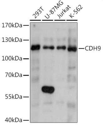 Western Blot: Cadherin-9 AntibodyAzide and BSA Free [NBP2-92182]