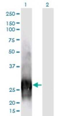 Western Blot: Calbindin D-28K Antibody (1F6) [H00000793-M01]