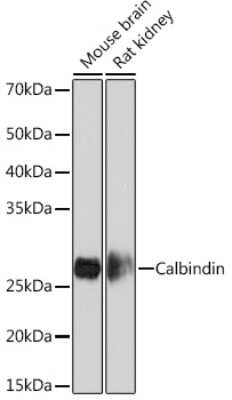 Western Blot: Calbindin D-28K Antibody (1K2K2) [NBP3-16209]