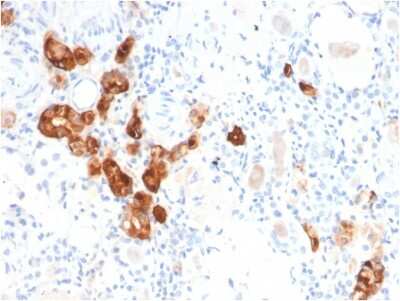 Immunohistochemistry-Paraffin: Calbindin D-28K Antibody (CALB1/2782) [NBP3-07208]