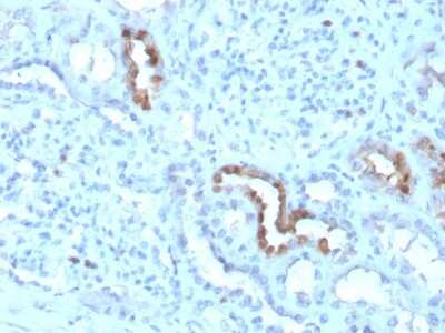 Immunohistochemistry-Paraffin: Calbindin D-28K Antibody (CALB1/3333) [NBP3-07364]