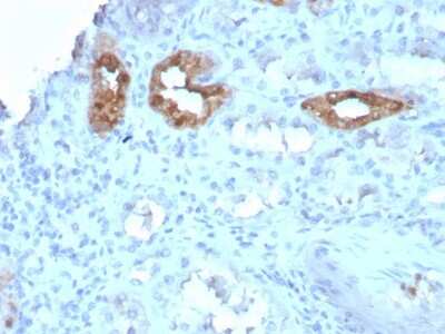 Immunohistochemistry-Paraffin: Calbindin D-28K Antibody (CALB1/3333) [NBP3-07364]