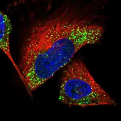 Immunocytochemistry/ Immunofluorescence: Calbindin D-28K Antibody [NBP1-86664]