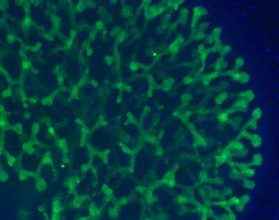 Immunocytochemistry/ Immunofluorescence: Calbindin D-28K Antibody [NBP2-50028]