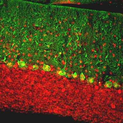 Immunohistochemistry Free-Floating: Calbindin D-28K Antibody [NBP2-50028]
