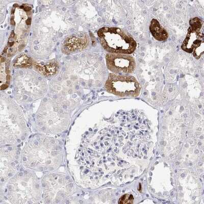 Immunohistochemistry: Calbindin D-28K Antibody [NBP2-38798]