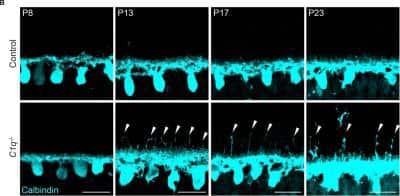 Immunohistochemistry: Calbindin D-28K Antibody [NBP2-50028]