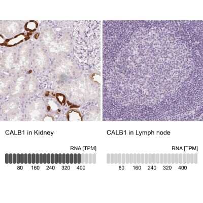 Immunohistochemistry-Paraffin: Calbindin D-28K Antibody [NBP1-86664]