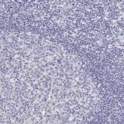Immunohistochemistry-Paraffin: Calbindin D-28K Antibody [NBP2-38798]