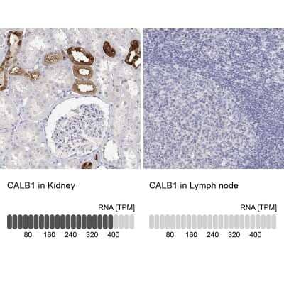 Immunohistochemistry-Paraffin: Calbindin D-28K Antibody [NBP2-38798]