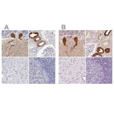 Immunohistochemistry-Paraffin: Calbindin D-28K Antibody [NBP2-38798]
