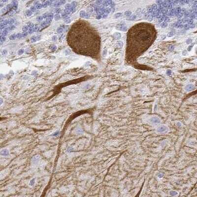 Immunohistochemistry-Paraffin: Calbindin D-28K Antibody [NBP2-38798]