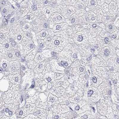 Immunohistochemistry-Paraffin: Calbindin D-28K Antibody [NBP2-38798]