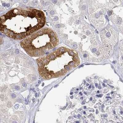 Immunohistochemistry-Paraffin: Calbindin D-28K Antibody [NBP2-38798]