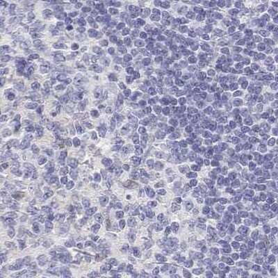 Immunohistochemistry-Paraffin: Calbindin D-28K Antibody [NBP2-38798]