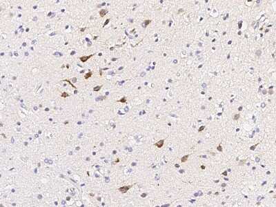 Immunohistochemistry-Paraffin: Calbindin D-28K Antibody [NBP2-99063]
